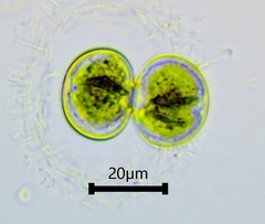 Cosmarium contractum