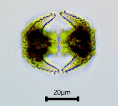 Staurastrum cerastes