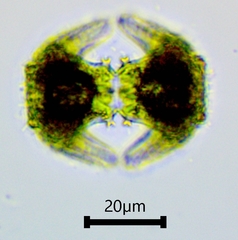 Staurastrum cerastes