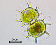 Xanthidium cristatum