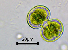 Cosmarium contractum