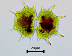 Xanthidium cristatum