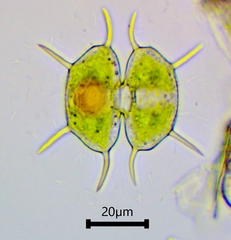 Xanthidium antilopaeum