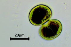 Cosmarium contractum