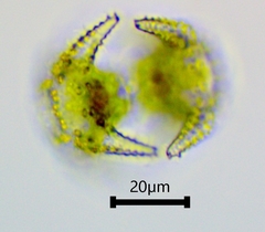 Staurastrum cerastes