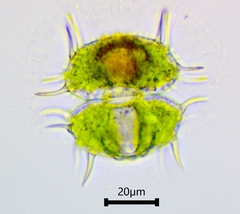Xanthidium antilopaeum