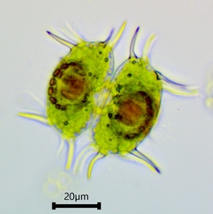 Xanthidium antilopaeum