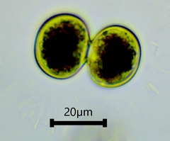 Cosmarium contractum