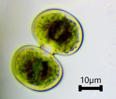 Cosmarium contractum