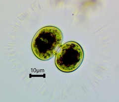 Cosmarium contractum