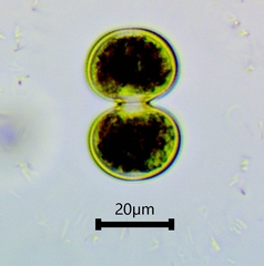 Cosmarium contractum