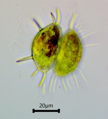 Xanthidium antilopaeum