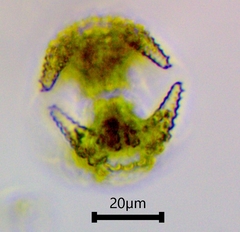 Staurastrum cerastes