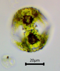 Staurastrum cerastes