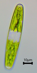 Closterium navicula