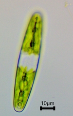Closterium navicula
