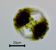 Staurastrum cerastes
