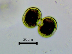 Cosmarium contractum