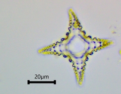 Staurastrum cerastes