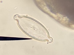 Caloneis amphisbaena