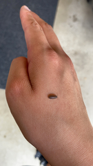 Armadillidium nasatum