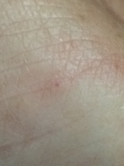Phlebotominae