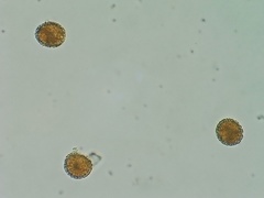 Coleosporium elephantopodis