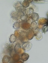 Coleosporium elephantopodis