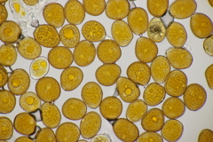 Puccinia asperulae-cynanchicae