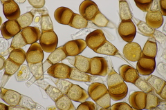 Puccinia coaetanea
