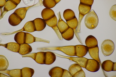 Puccinia pedunculata