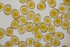 Puccinia pedunculata