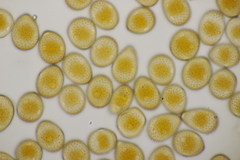 Puccinia pedunculata