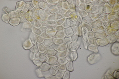 Puccinia sii-falcariae
