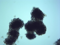 Dolichospermum lemmermannii