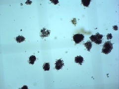 Dolichospermum lemmermannii