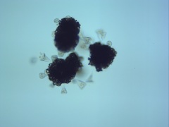 Dolichospermum lemmermannii