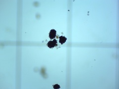 Dolichospermum lemmermannii