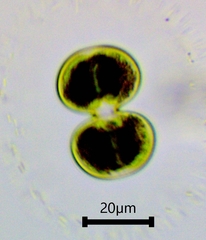 Cosmarium contractum