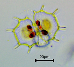 Xanthidium cristatum