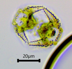 Staurastrum cerastes
