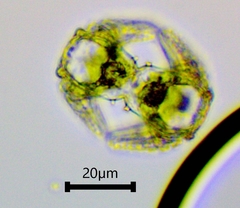 Staurastrum cerastes