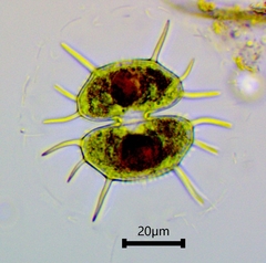 Xanthidium antilopaeum