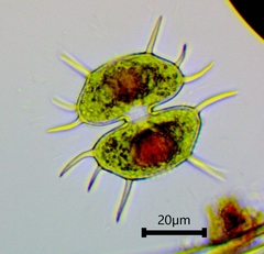 Xanthidium antilopaeum