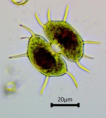 Xanthidium antilopaeum