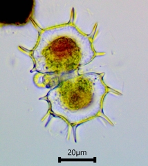 Xanthidium cristatum