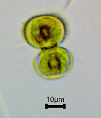 Cosmarium contractum