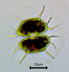 Xanthidium antilopaeum