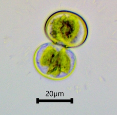 Cosmarium contractum