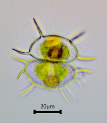 Xanthidium antilopaeum